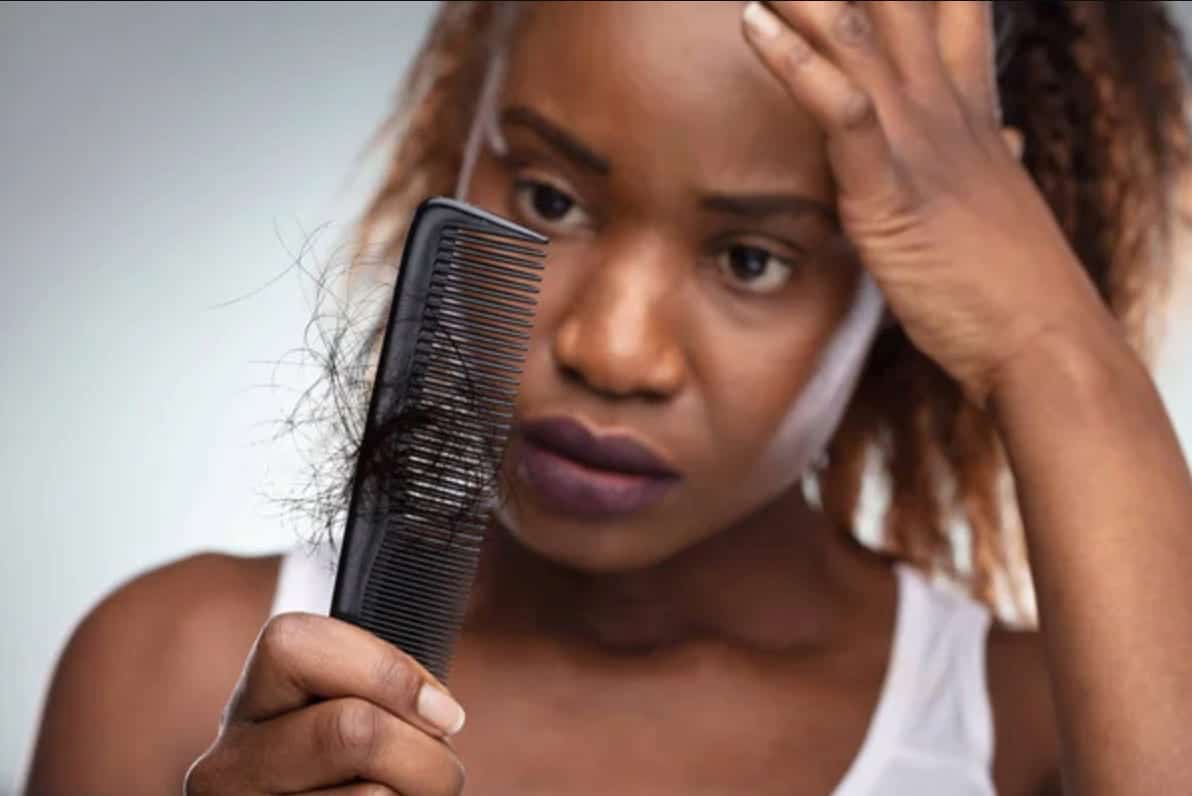This post is mainly for women also dealing with recession at their temples.  I know this type of hair loss is mostly associated with men and I just want  to say that